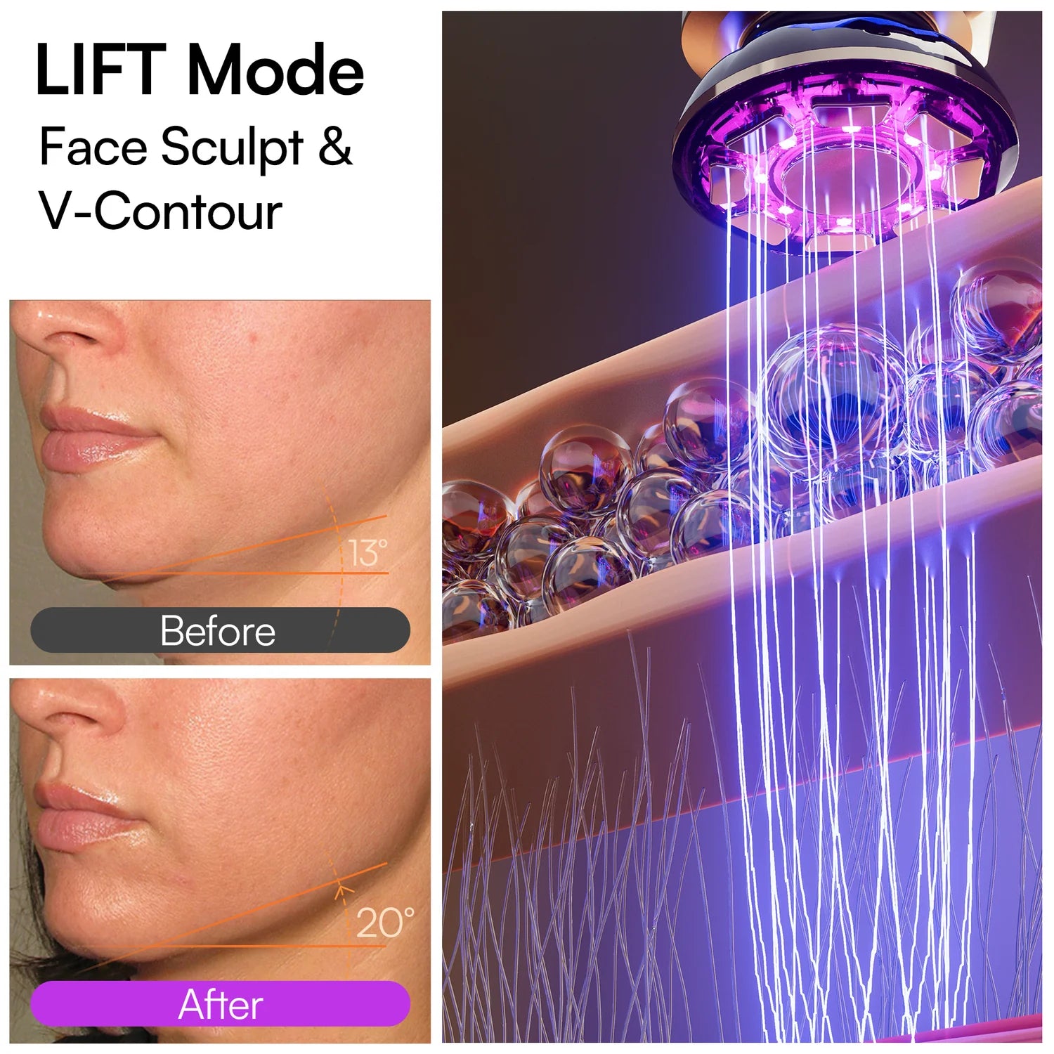 INIA FLARE Microcurrent Facial Device